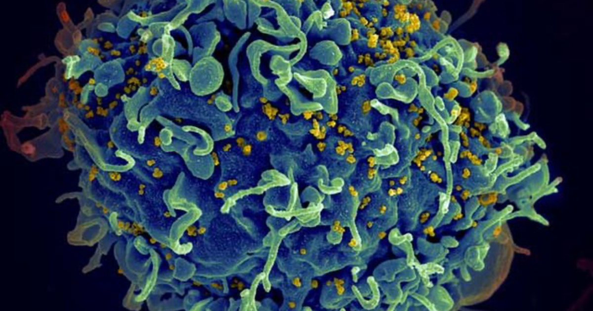 Célula humana atacada por el VIH, que ocasiona el SIDA © Wikimedia Commons / National Institute of Allergy and Infectious Diseases