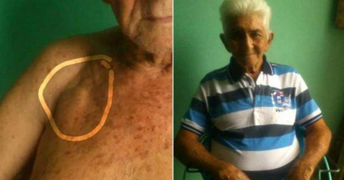 Anciano cubano que necesita marcapasos © Ivo Laffite Rodriguez / Facebook