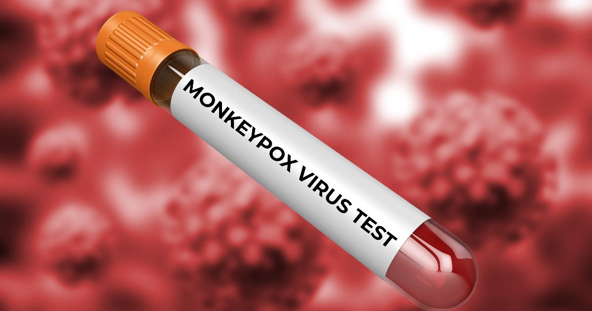 Test para detectar viruela del mono (Imagen de referencia) © <a href="https://sp.depositphotos.com/">Depositphotos</a>