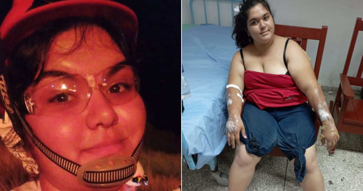 Carema Sarabia Águila, miembro de la Cruz Roja Cubana, lesionada durante el incendio en Matanzas © Facebook/ Cubadebate