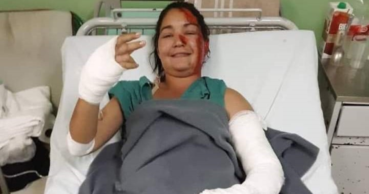  Laura Perdomo Pérez, lesionada en incendio de Matanzas © Radio Rebelde
