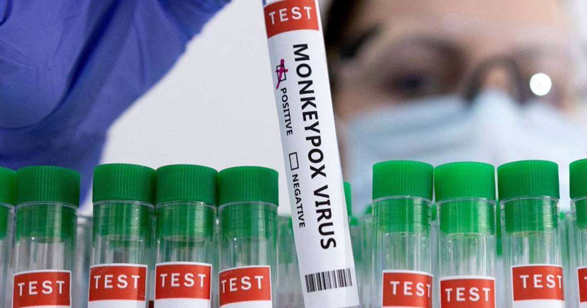 Test de detección de la viruela símica © Twitter / Aristegui Noticias