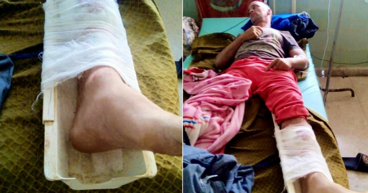 Paciente en Cuba al que inmovilizaron la pierna con un plástico © Collage Facebook/ Marisol Peña Cobas