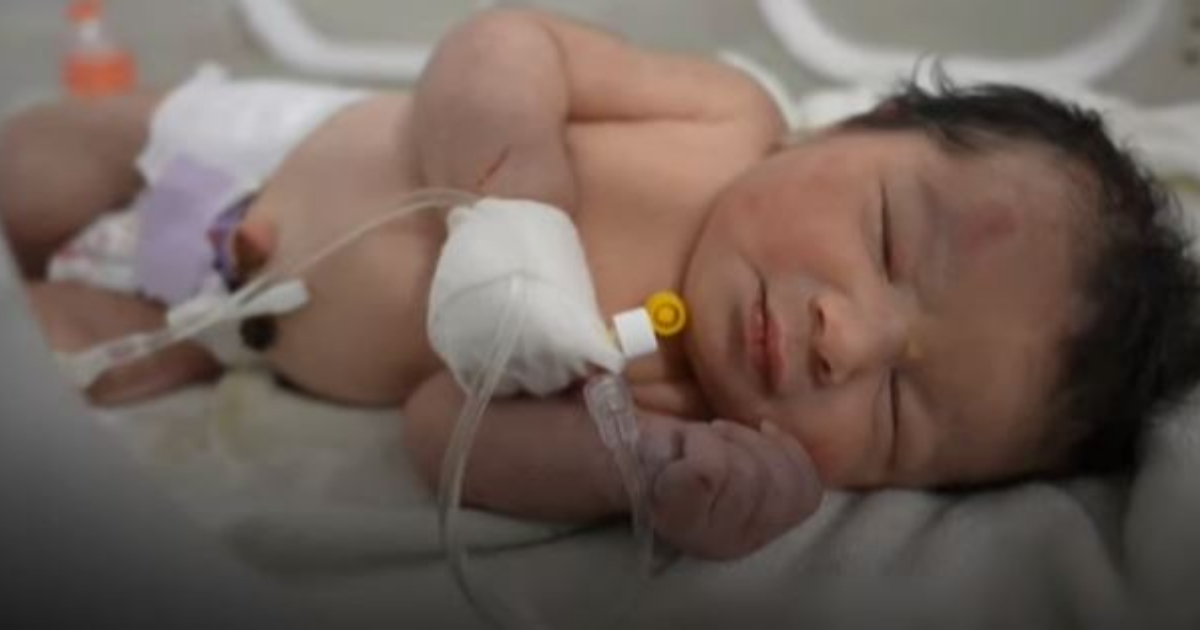 Bebé milagro de Siria © BBC