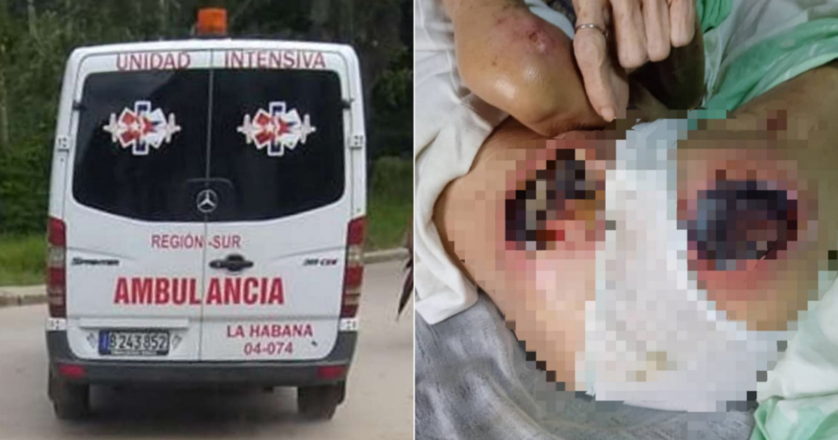 Anciana cubana con úlceras en el cuerpo © Facebook / El Gremio Médico Cubano Libre