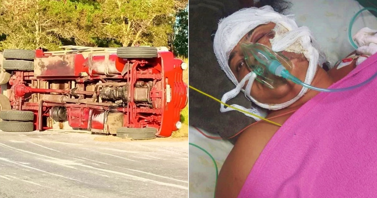 Camión de pasajeros accidentado (i) y cubana lesionada en el trágico accidente (d) © Collage Facebook/Radio Guamá- Facebook/Accidentes Buses & Camiones