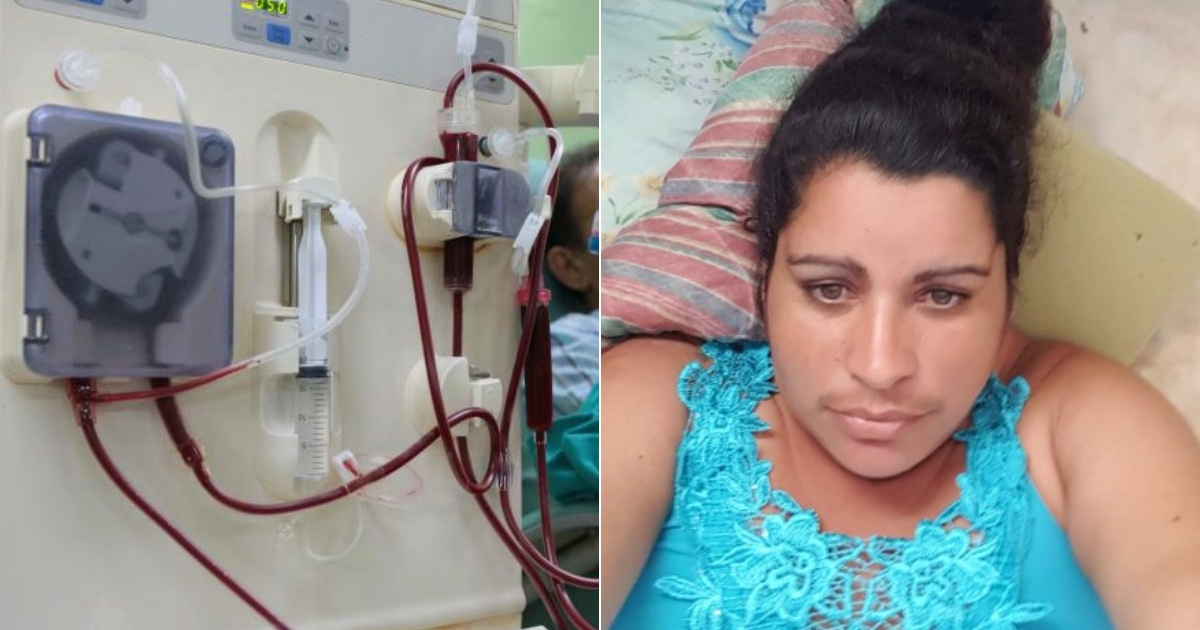 Photo of Una donna deceduta e diverse persone affette da epatite C dopo l’emodialisi a Holguín