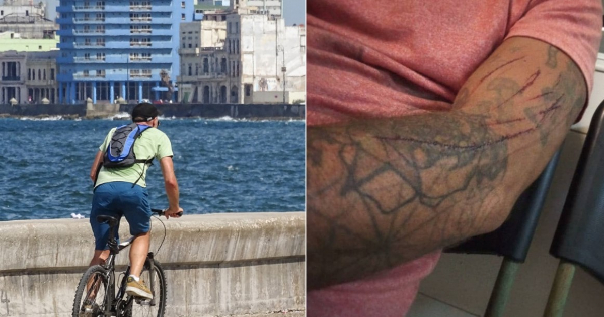 Cubano en bicicleta y heridas sufridas por el joven © CiberCuba y Facebook / Michi Blokeada OtraVez Garcia 