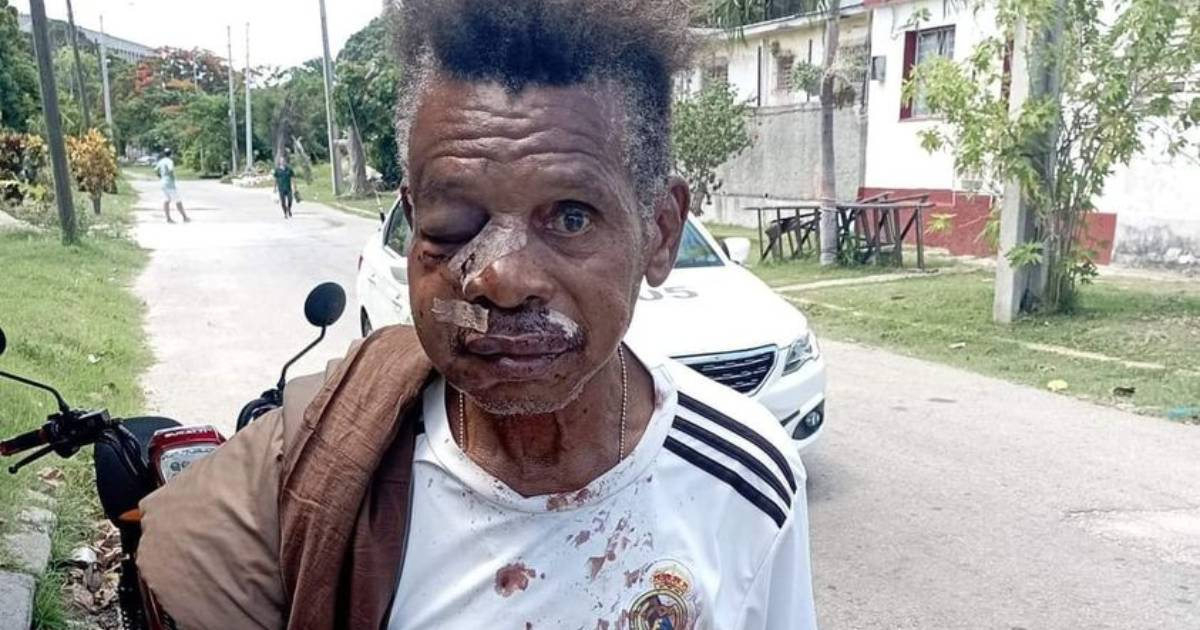 Trabajador de un parqueo en La Habana golpeado © Facebook / Michaela Días García