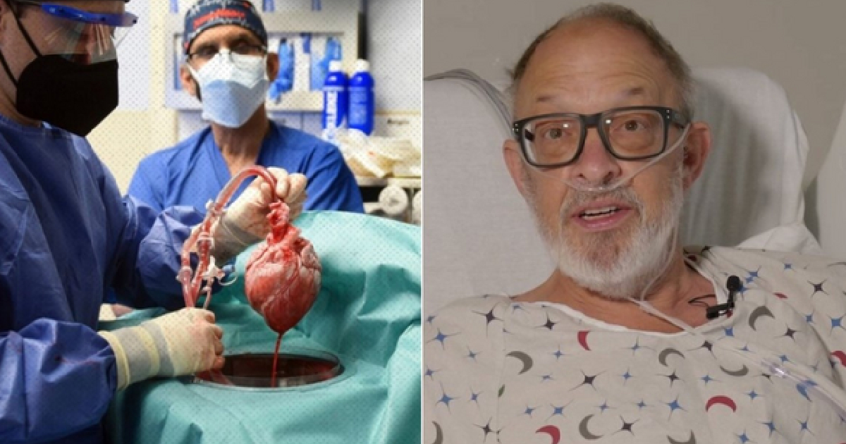 Segunda operación de trasplante con corazón de cerdo © Asumsi y CNN