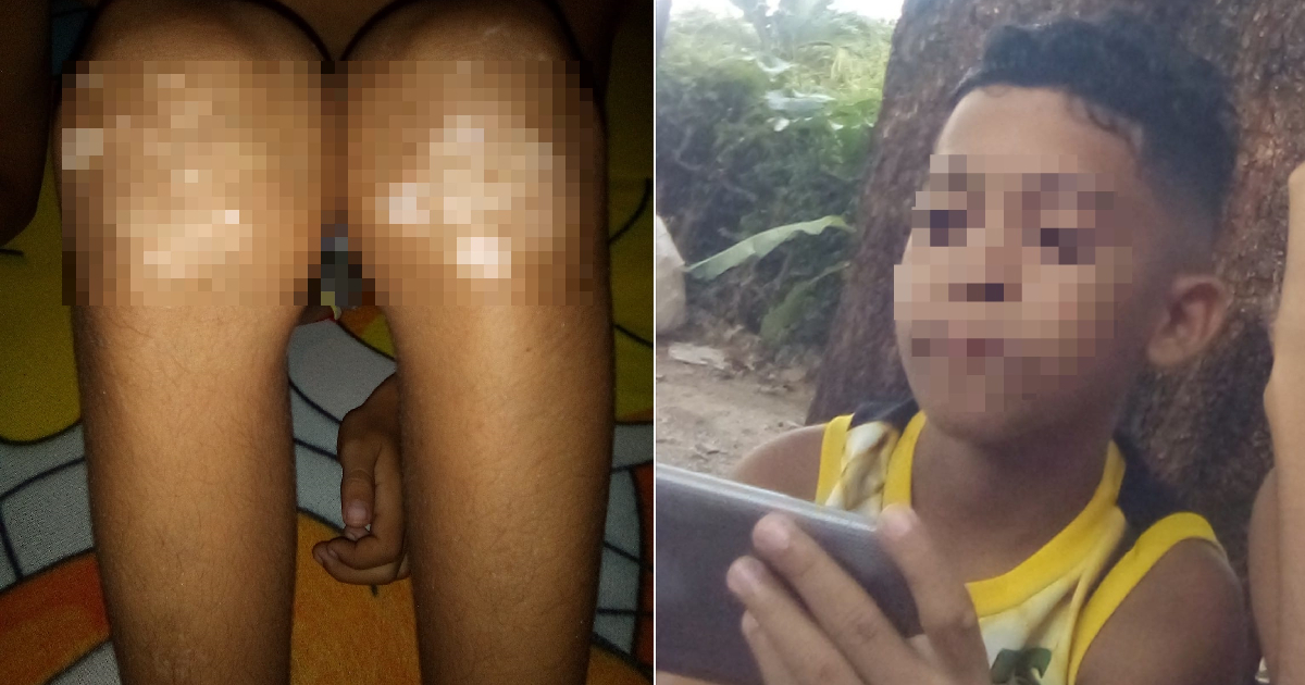 Niño con vitiligo necesita medicamentos © Facebook/Madres cubanas por un mundo mejor/Leidis Labradas