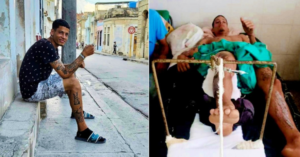 El joven antes y después del accidente © Collage Facebook/Yosmany Mayeta Labrada