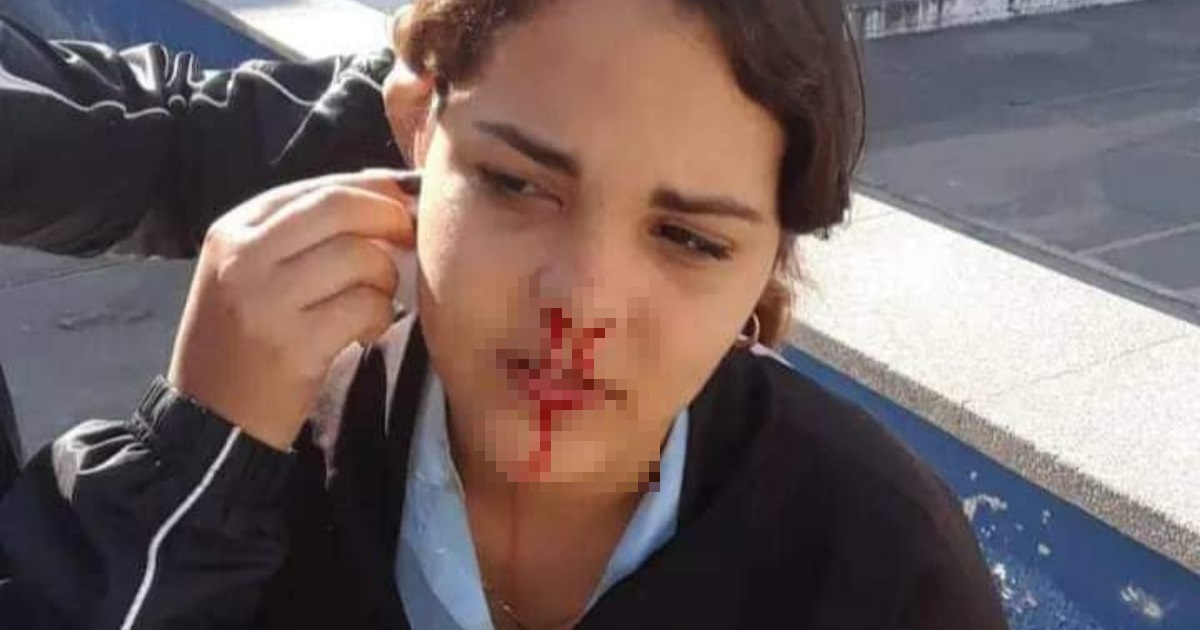 Leyanis Montero sangrando por la nariz y oídos © Leyanis Montero / Facebook
