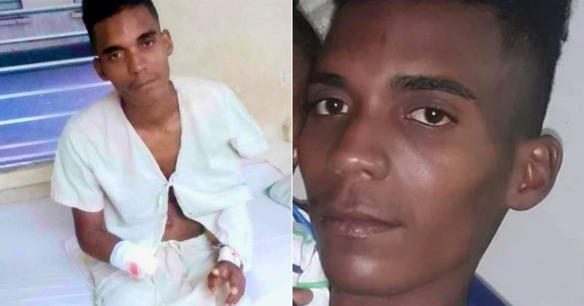 Joven mutilado (i) y Joven santiaguero víctima de la agresión (d) © Collage Facebook/Yosmany Mayeta Labrada