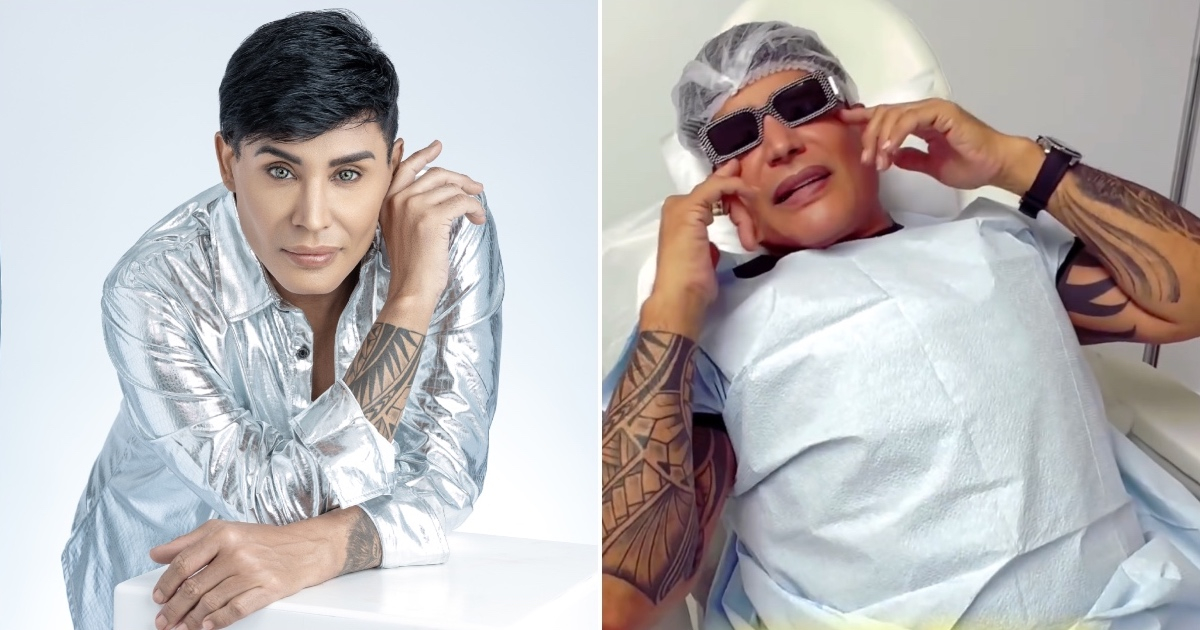 Eduardo Antonio Undergoes New Cosmetic Surgery: "I Don't Like How I Look"