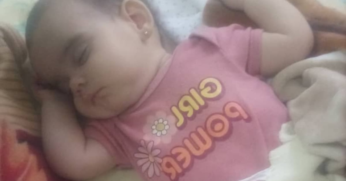 Family Seeks Assistance for Surgery on Infant with Brain Tumor in Matanzas