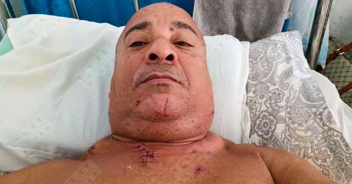 The president of the Jovan club has recovered after he was stabbed in Santiago de Cuba