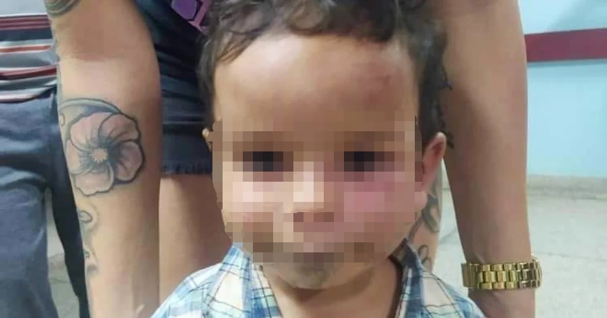 Outrage Over Cuban Mother's Assault on Her Young Son