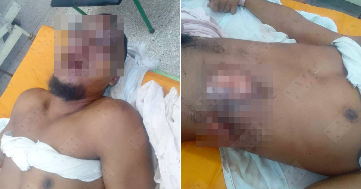 Young Man in Critical Condition after Jumping from Roof in Santiago de Cuba