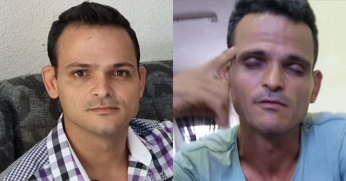 Cuban Man with Schizophrenia Remains Detained Despite Dropped Charges