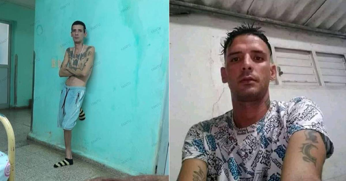 Cuban Regime Frees 11J Prisoner with Tongue Cancer