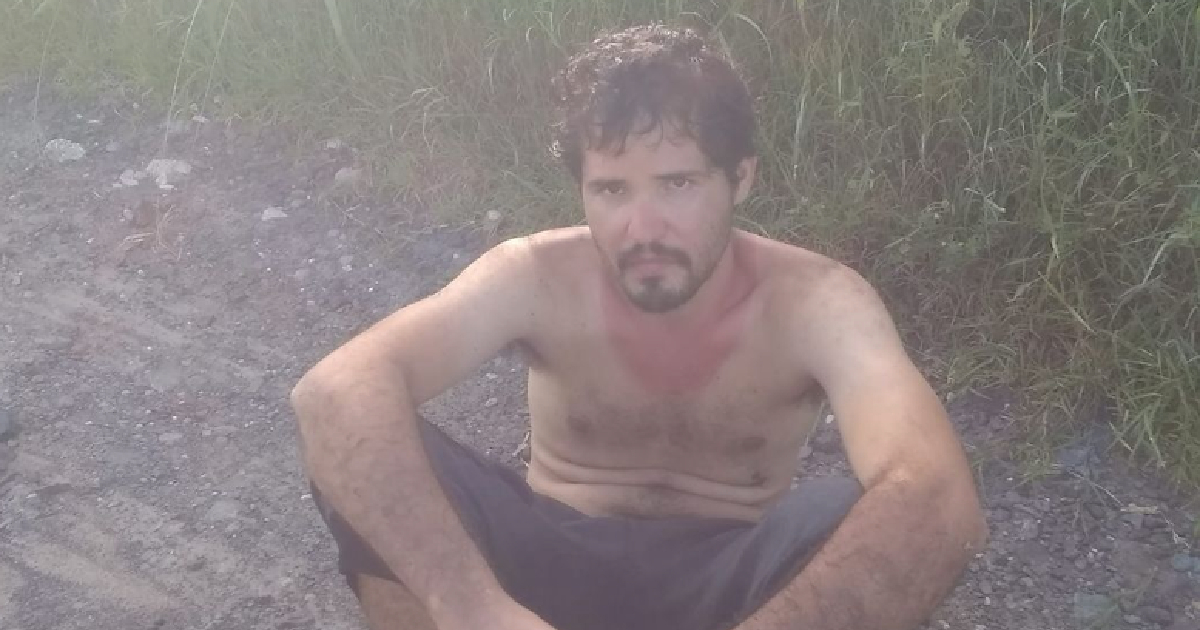 Missing Cuban Found with Severe Sunburn on Las Tunas Highway