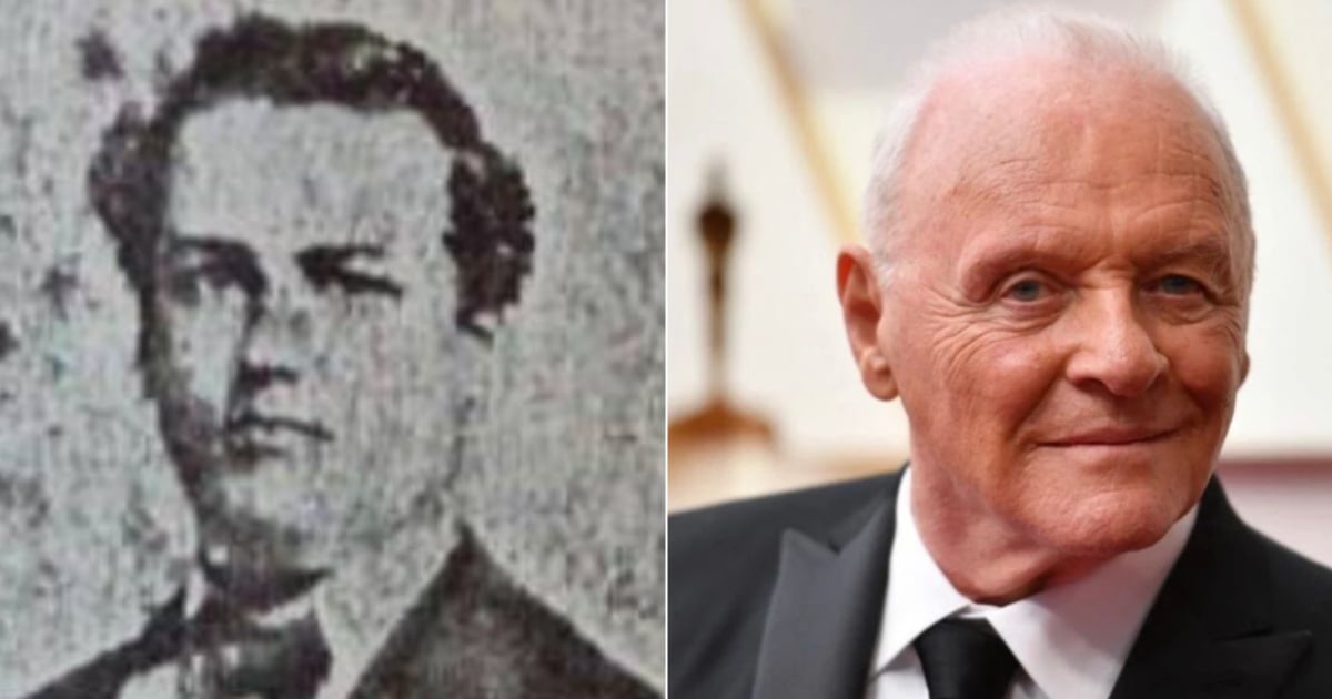 Anthony Hopkins Mistaken for Deceased Cuban Doctor by Government Media