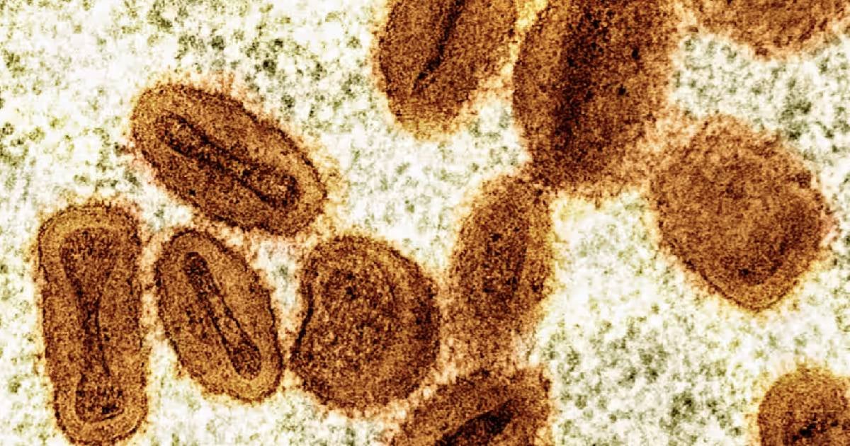 New Monkeypox Variant Found in Traveler from the Congo, U.S. Health Officials Report