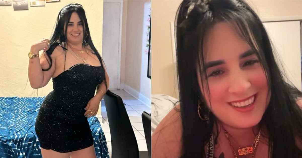 Madre cubana muere tras someterse a una cirugía estética en Miami