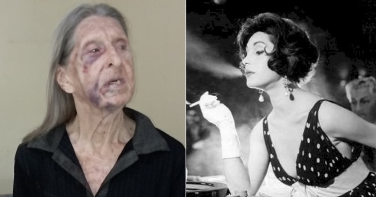 Norka Méndez, la modelo cubana más famosa, necesita ayuda tras sufrir un accidente doméstico: "Está en el olvido"
