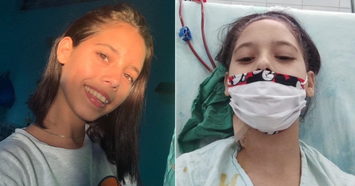 Young Cuban Woman with Chronic Kidney Failure Seeks Transplant Help Abroad: "I Want to Live"