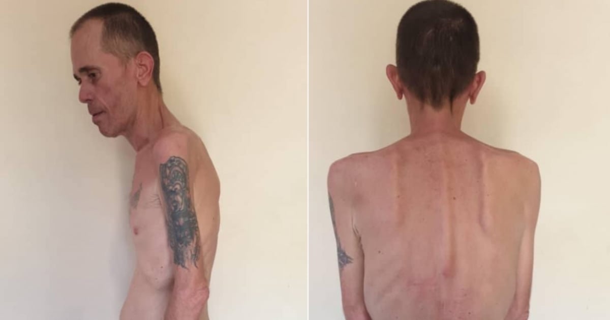 Cuban Political Prisoner with Cancer: The Dire Conditions Inside Cuban Prisons