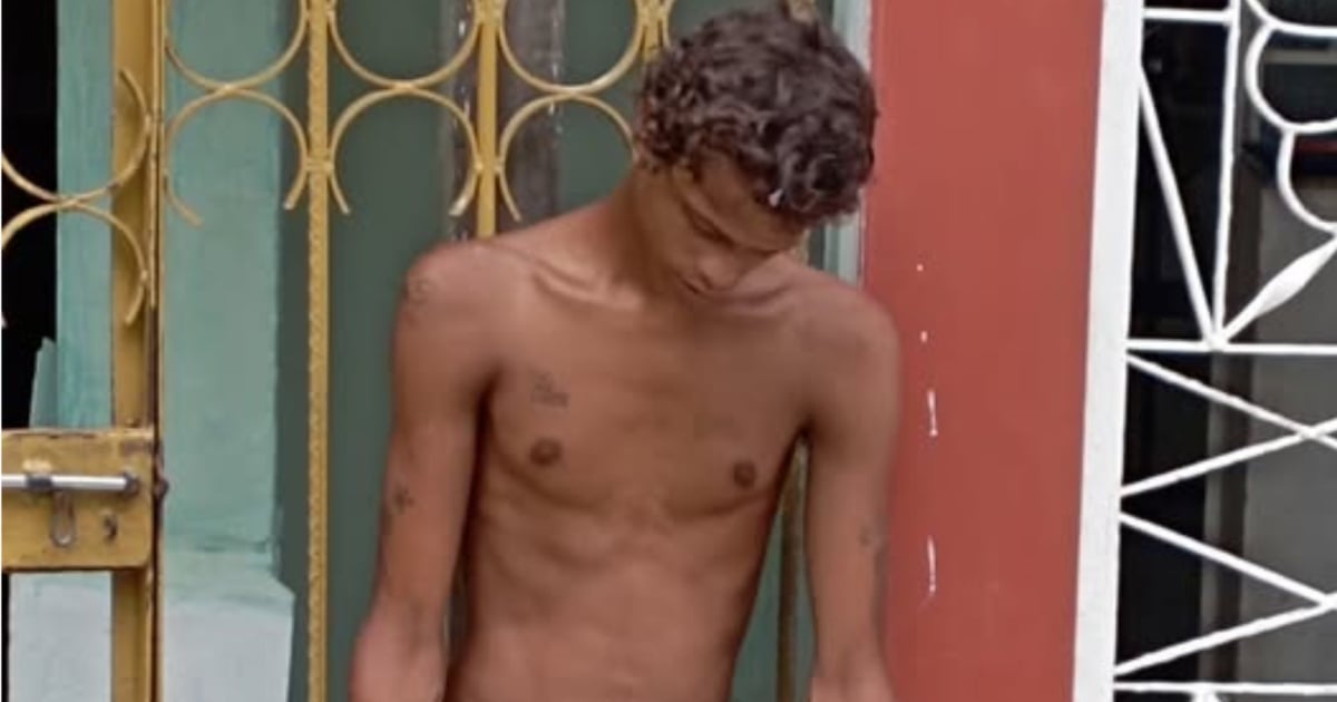 Desperation in Cuba Over Young Man Affected by Dangerous Drug: "We're at a Loss"