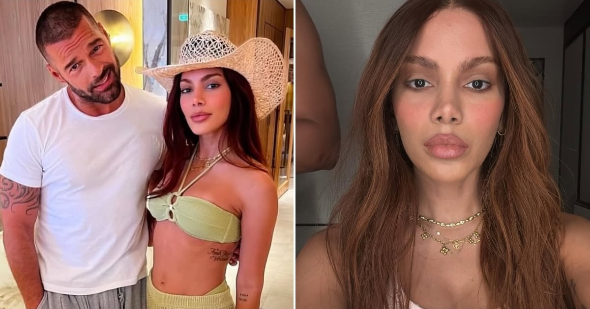 Anitta's Transformation Stuns Fans as She Returns After Two Months