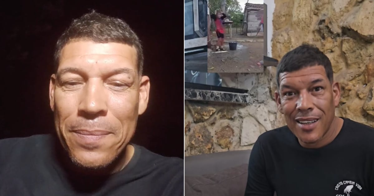 Limay Blanco Recauda más de 2000 Doláres para Niña Víctima de Maltrato en Holguín 6 limay blanco