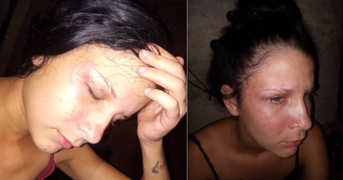 Police Inaction Criticized After Teen Assault in Pinar del Río