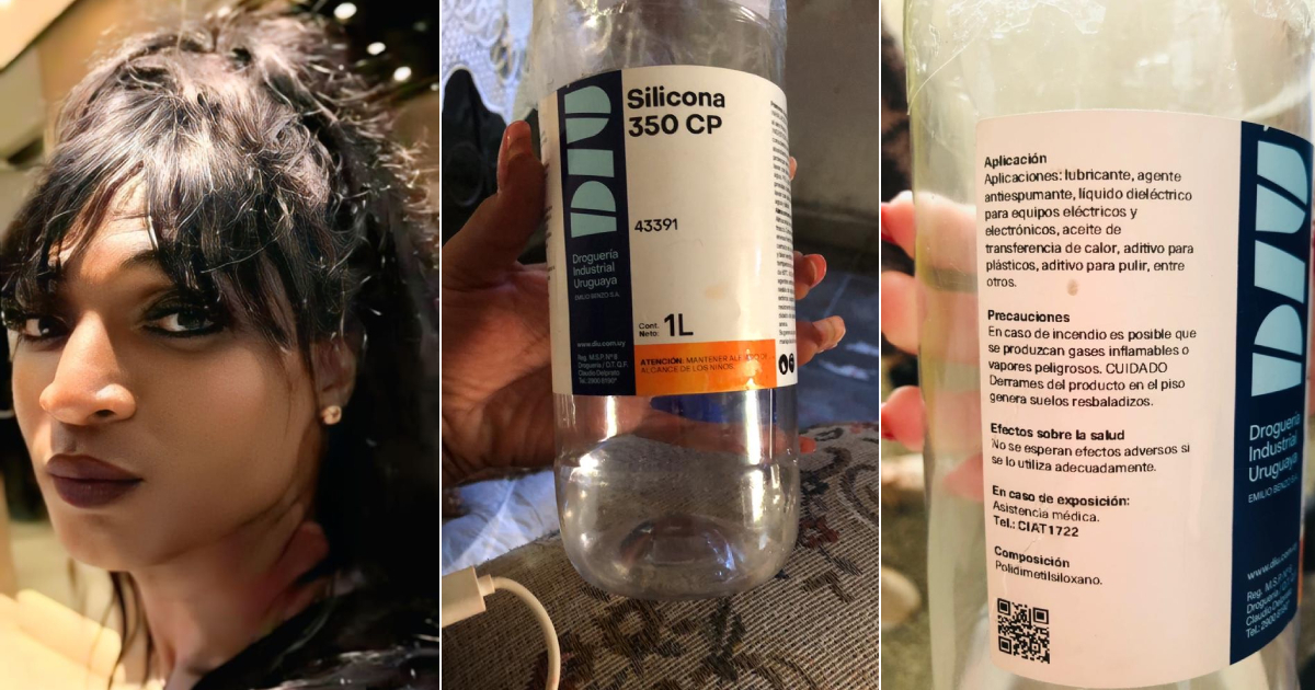 Tragic Loss Highlights Risks of Illegal Cosmetic Procedures: Cuban Trans Woman Dies After Industrial Silicone Injection