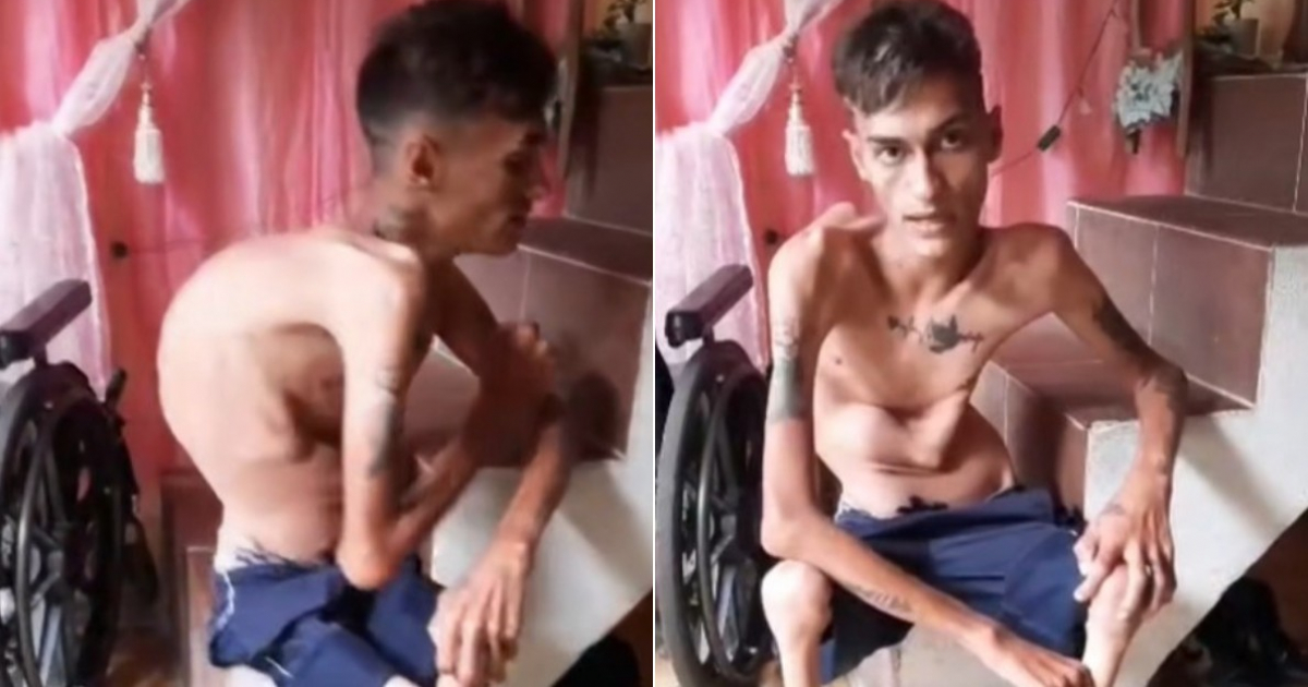 Young Cuban with Disability Seeks Community Support for Wheelchair Battery
