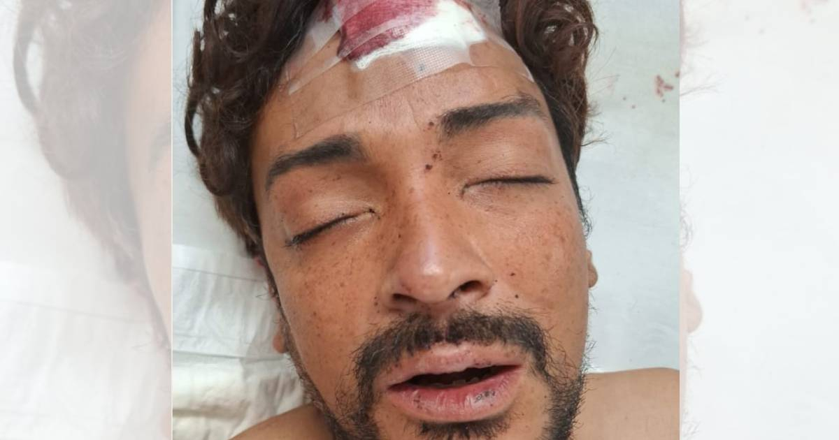 Cuban hospitalized in Mexico and no one knows who he is: Urgently searching for his family