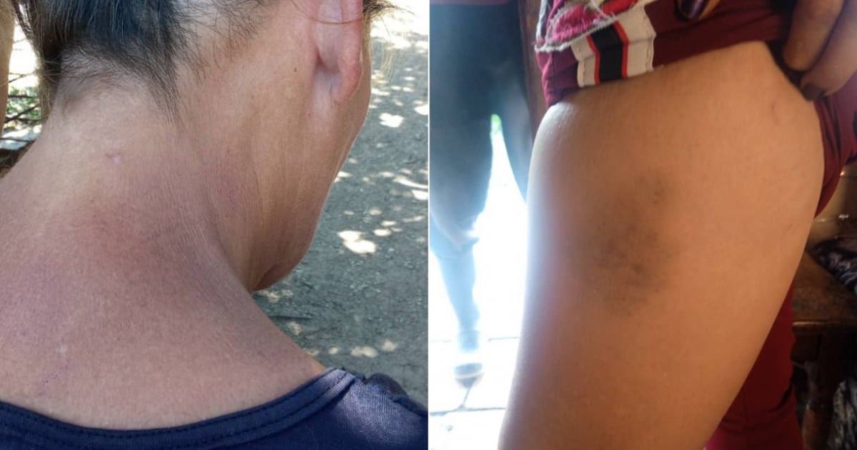 Mother Reports Brutal Crackdown During Protests in Guanabacoa