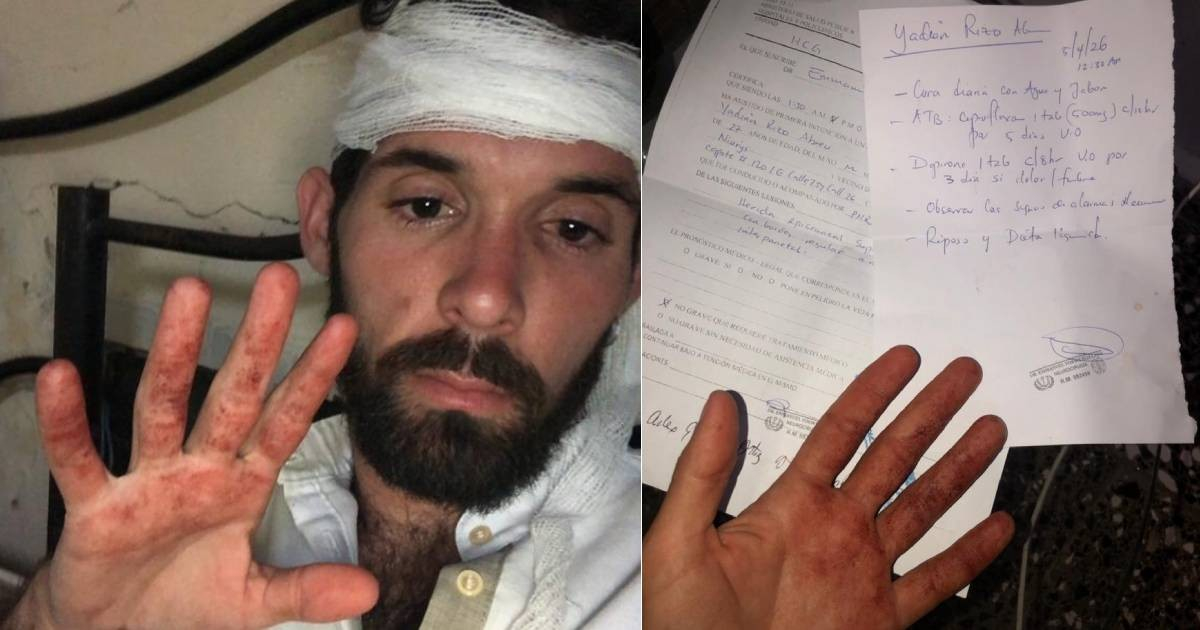 Cuban Artist Suffers Violent Assault During Cultural Event in Havana