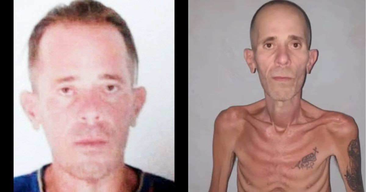 Cuban Dissident Exposes Dire Condition of Freed Political Prisoner: "He Looks Like He Walked Out of a Nazi Concentration Camp"