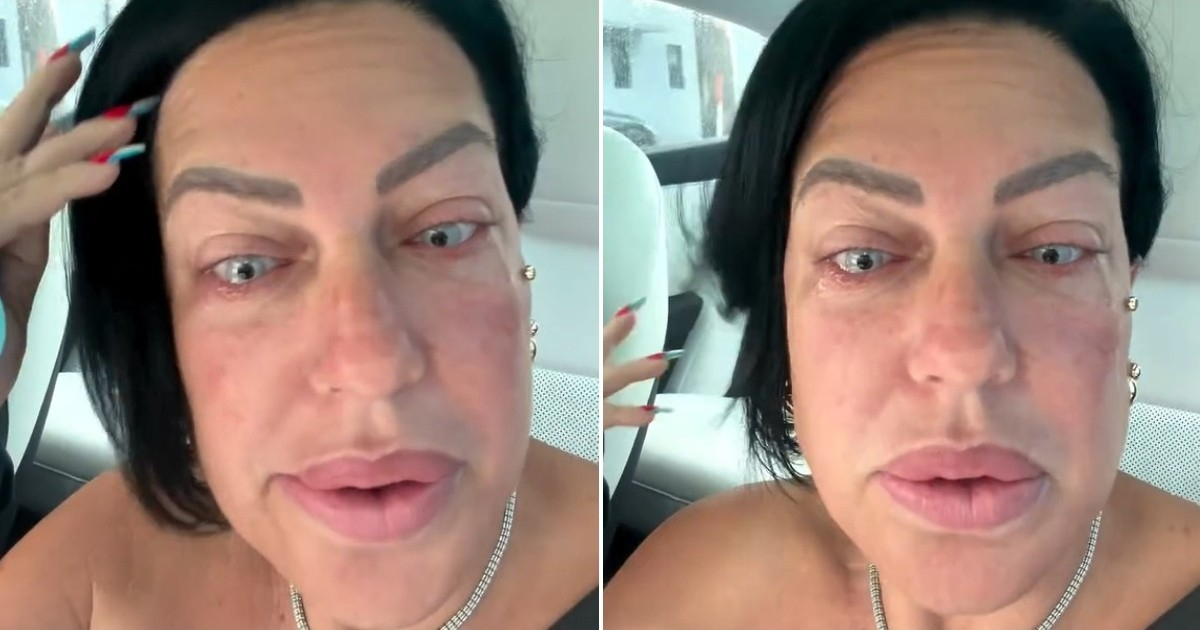 Singer La Diosa Enhances Eye Color Through Surgery and Reveals the Cost of the Procedure