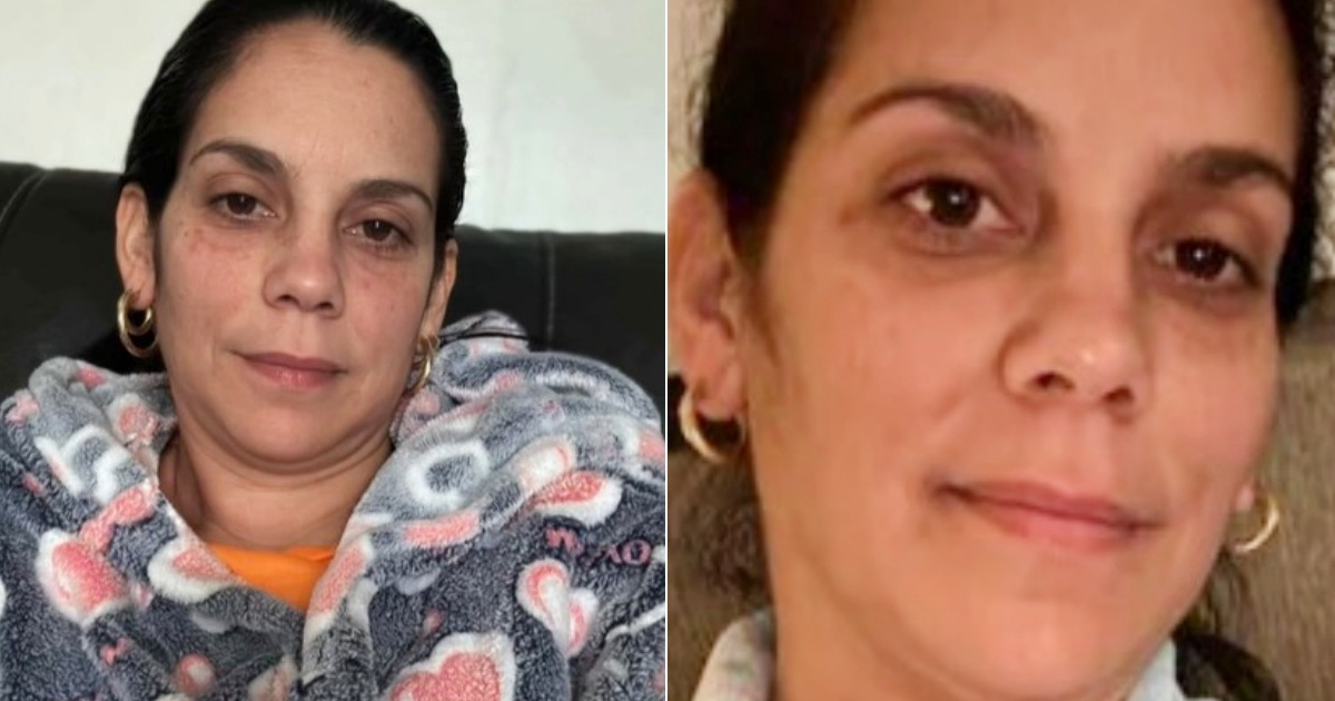 Cuban Mother in Hialeah Fighting Cancer Seeks Assistance: Her Struggle Unveiled