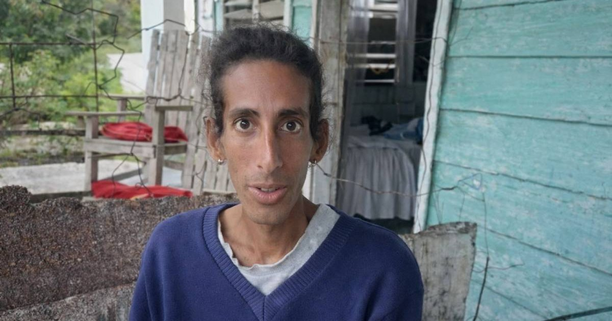 Julio's Story: A Cuban Man Living with HIV Receives Heartfelt Support After Viral Case on Social Media