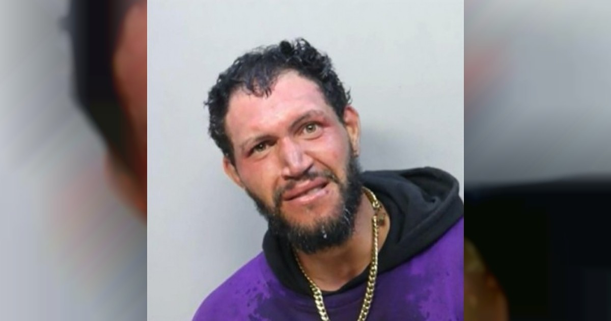 Cuban Man, 27, Dies in ICE Custody in Miami