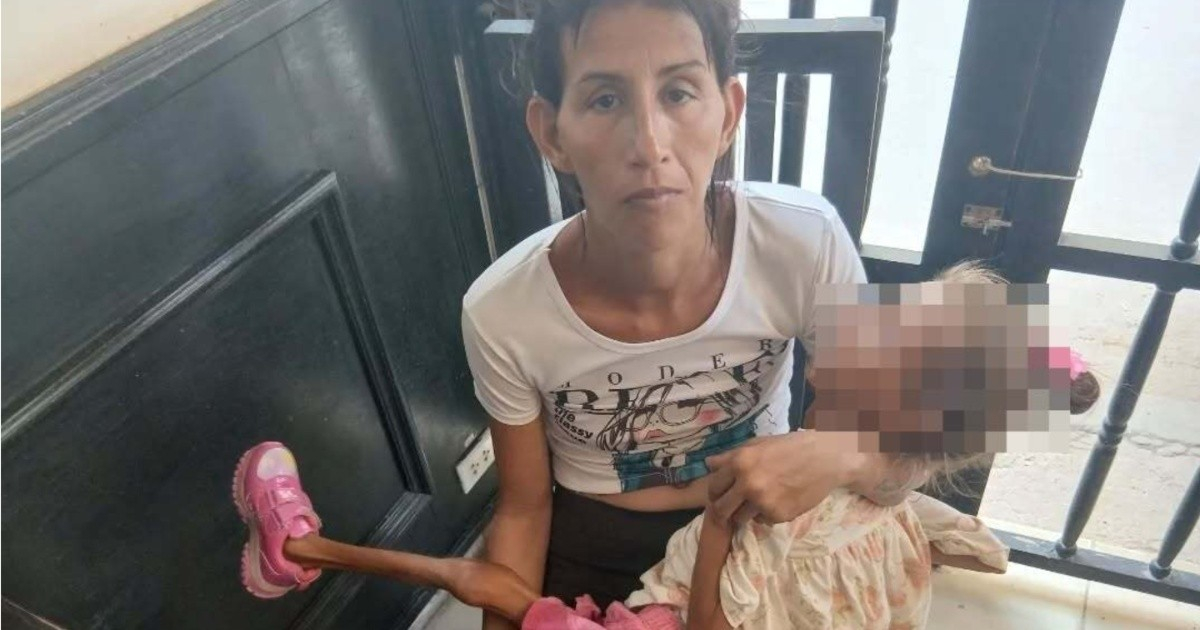 Help is being sought for a girl in Cuba showing signs of severe malnutrition