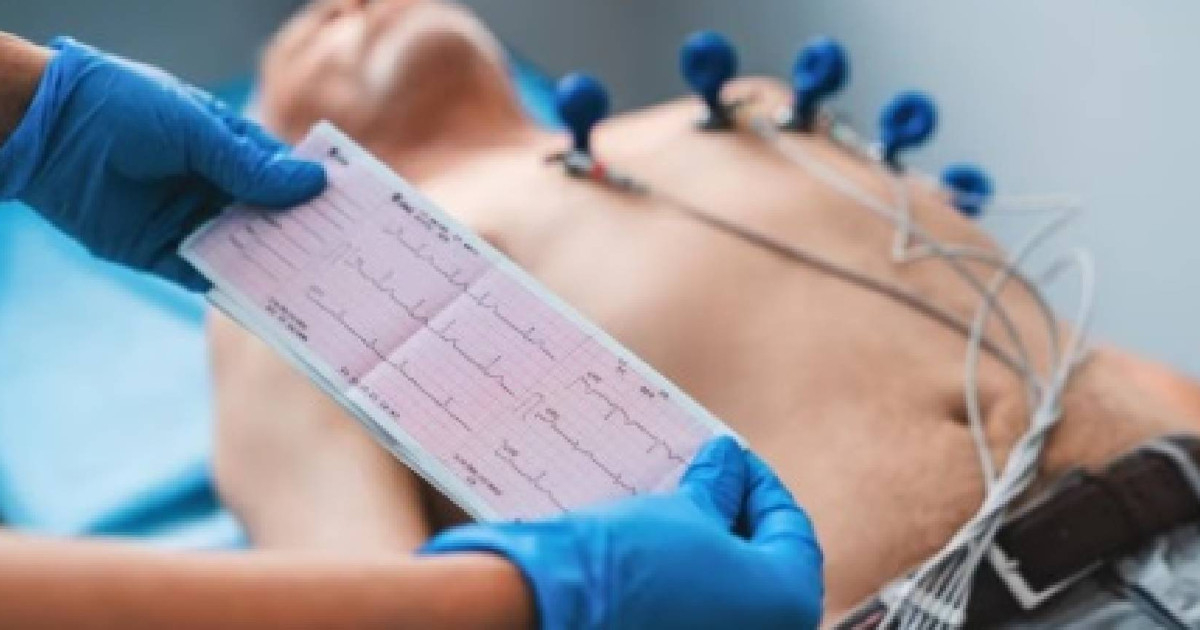 "The Niagara by Bicycle": Patient suspected of a heart attack visits three medical centers in Camagüey and ends up with a photographed electrocardiogram