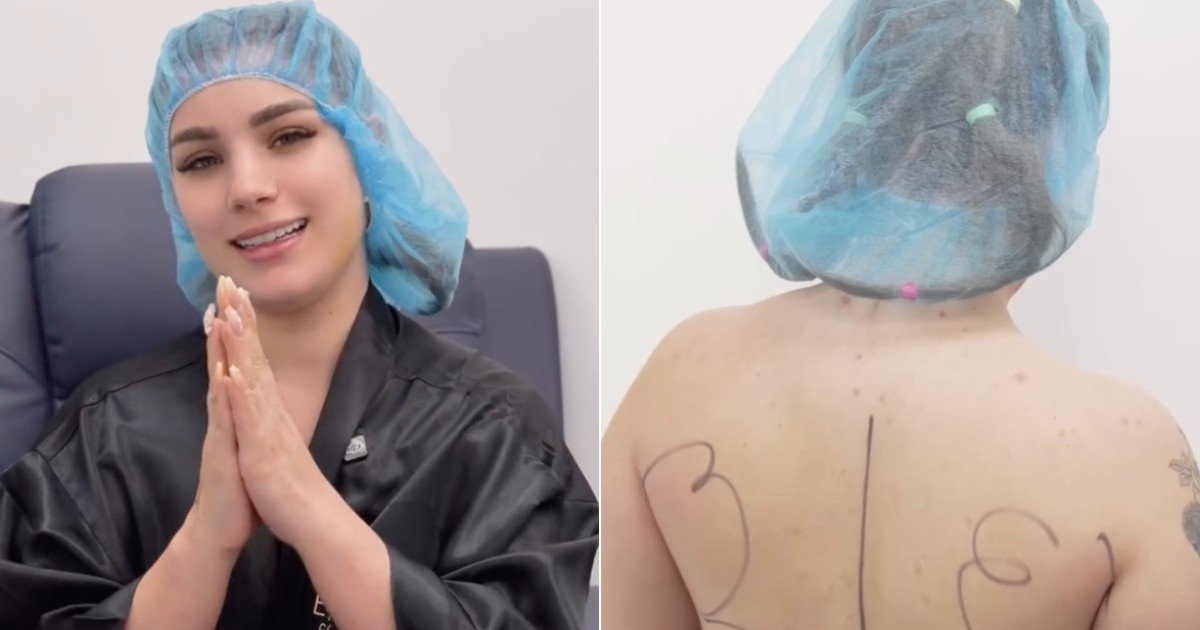 Claudia Artiles Unveils Her New Look After Recent Cosmetic Surgery: "I Got the Body Done"