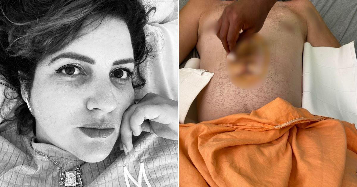 Bravery Shouldn't Cost a Life: Cuban Woman Exposes Heinous Attack on Her Brother